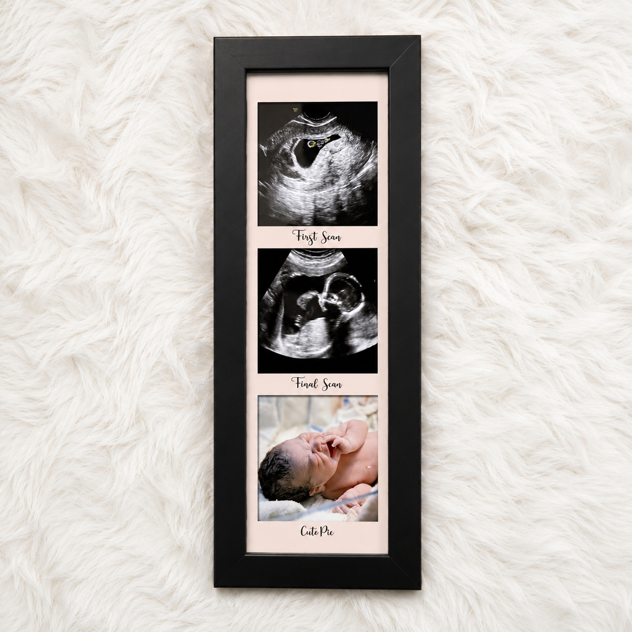 Baby scan frame